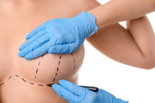What to Expect From Your Breast Lift Consultation