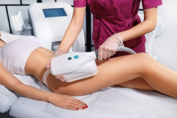 CoolSculpting Is an Ideal Procedure for Men and Women