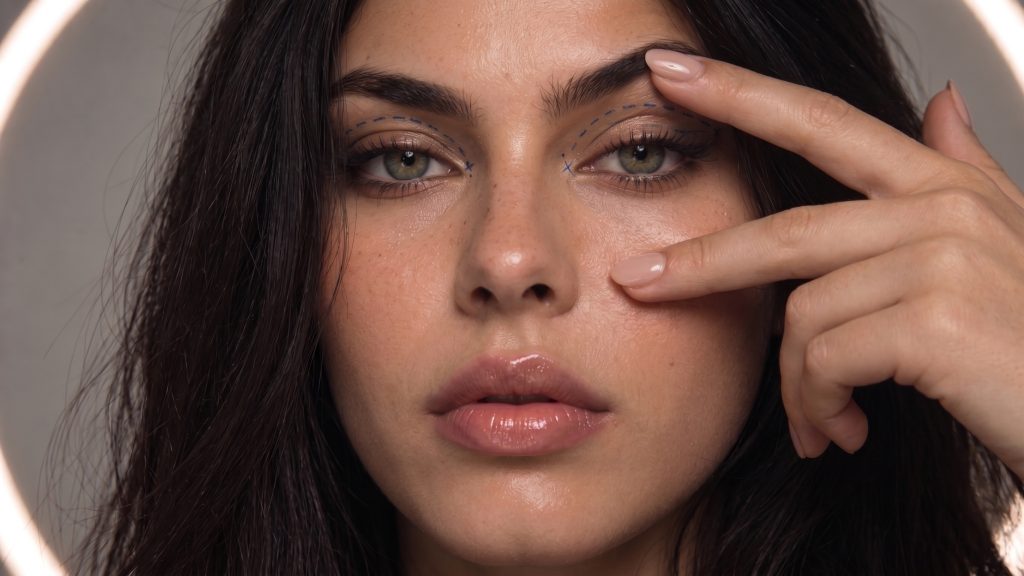 Woman with eyelid surgery markings gently lifting the skin around her upper eye.