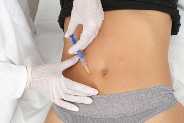 What Is A Drainless Tummy Tuck