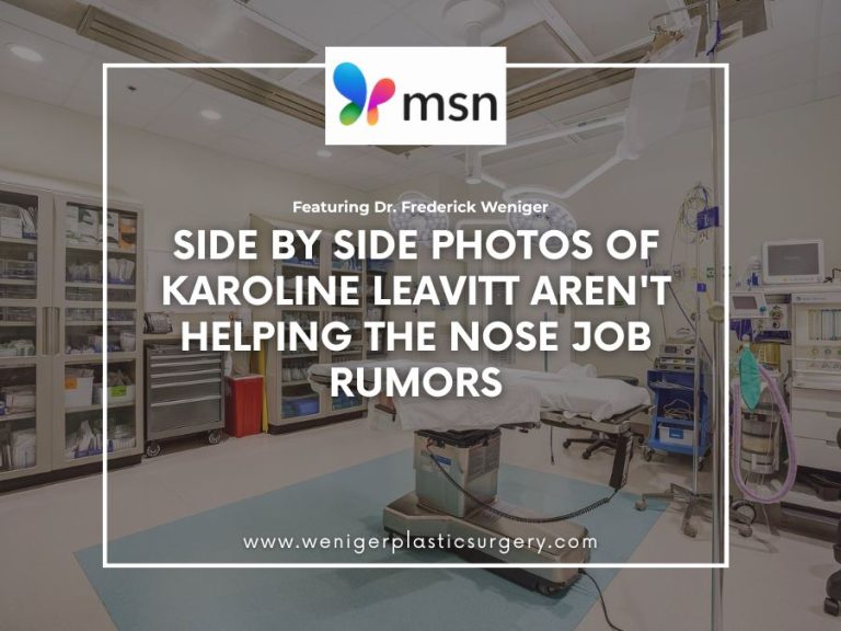 Side By Side Photos Of Karoline Leavitt Aren’t Helping The Nose Job Rumors